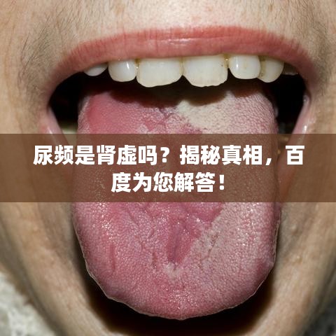 尿频是肾虚吗?揭秘真相,百度为您解答!