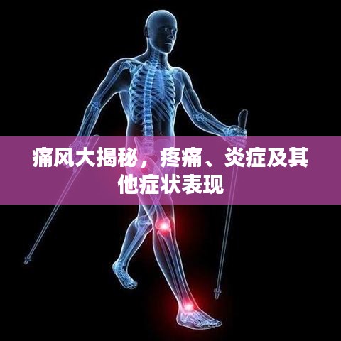 痛风大揭秘,疼痛、炎症及其他症状表现