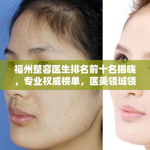 福州整容医生排名前十名揭晓,专业权威榜单,医美领域领军人物!