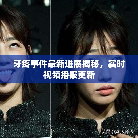 牙疼事件最新进展揭秘,实时视频播报更新