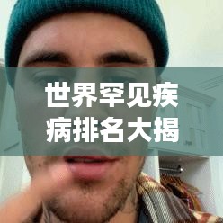 世界罕见疾病排名大揭秘,症状、影响与防治知识一网打尽